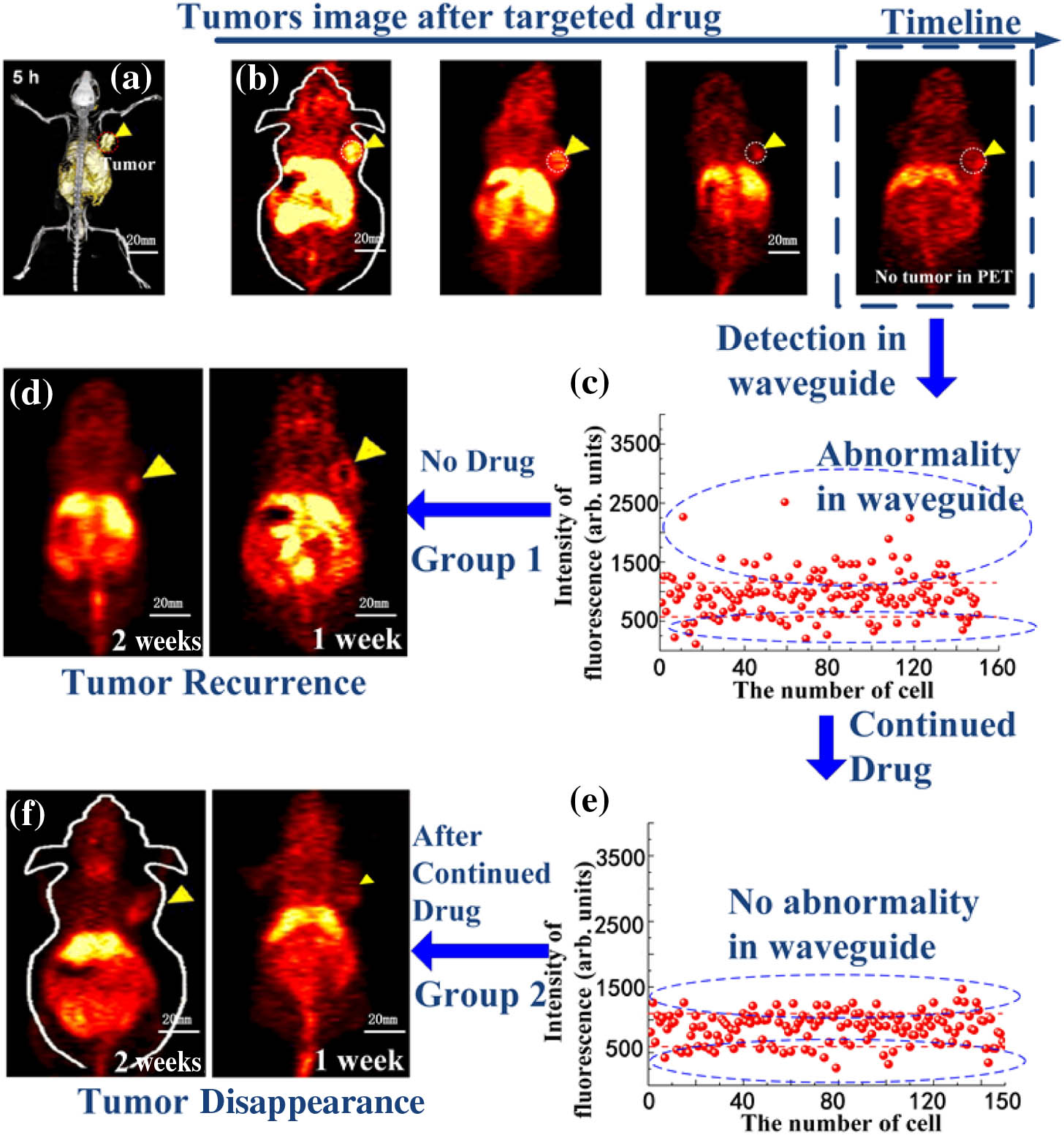 Pet Scan for Rectal Cancer: Understanding the Role of PET Imaging in Diagnosing and Managing Rectal Tumors